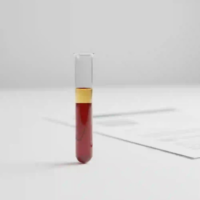 lustracija epruvete sa uzorkom krvi i laboratorijskog izveštaja (anti-CCP/CCP test).